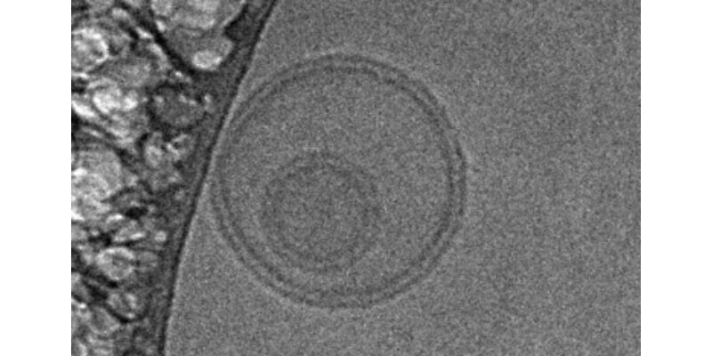 Small extracellular vesicles (sEVs) Small extracellular vesicles (sEVs)